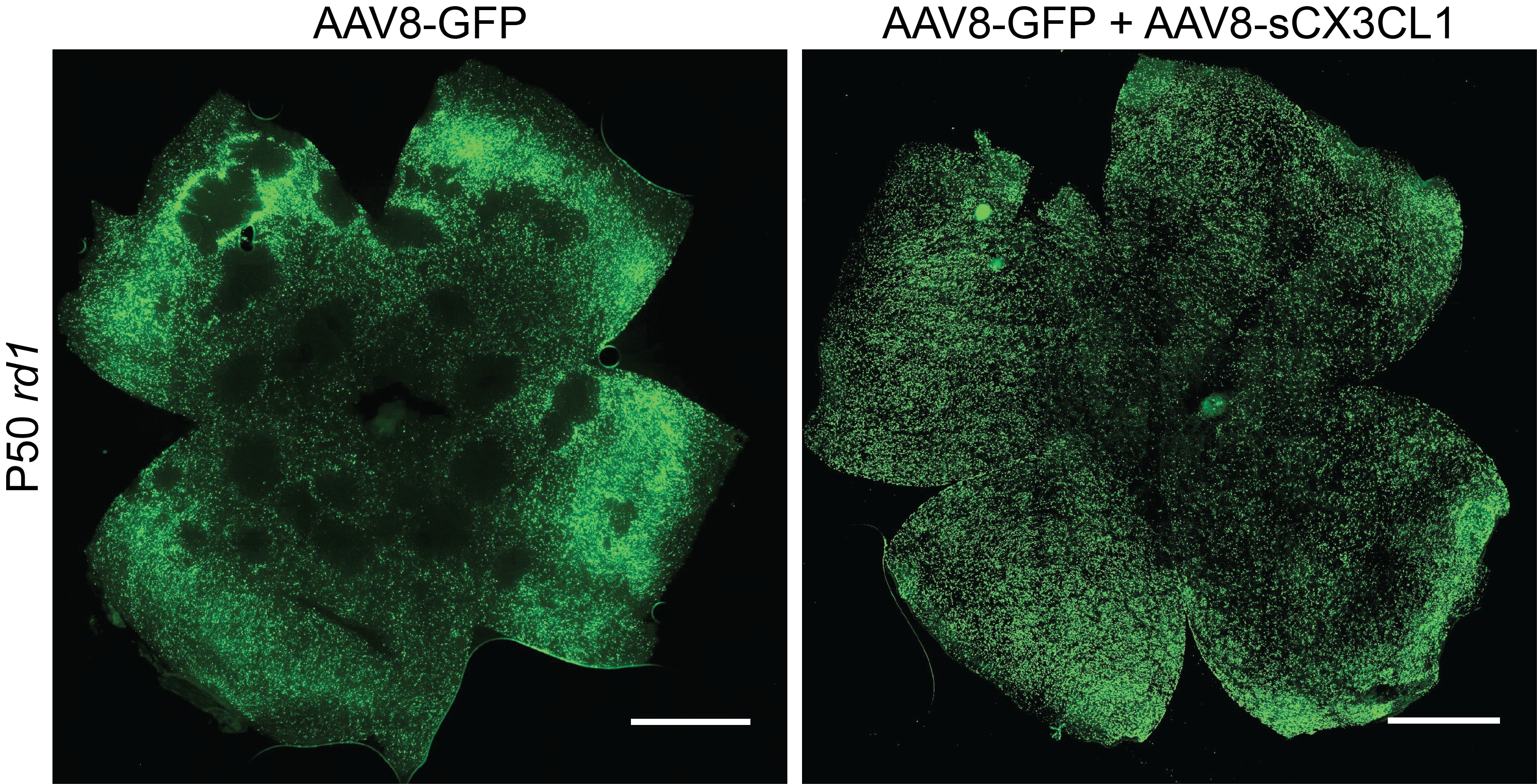 CX3CL1 gene therapy retinitis pigmentosa