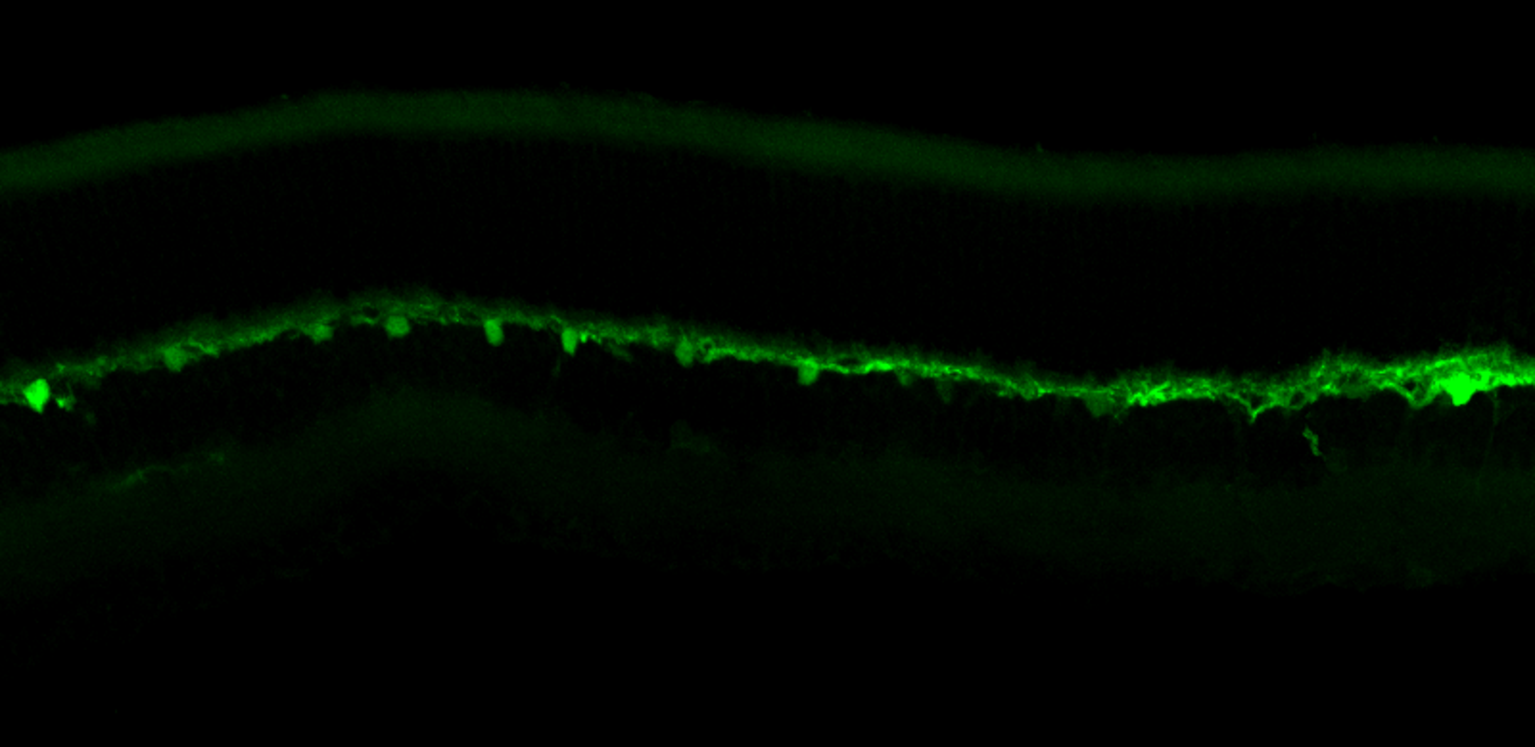 Fluorescence microscopy showing synthetic promoter expression in retinal cells