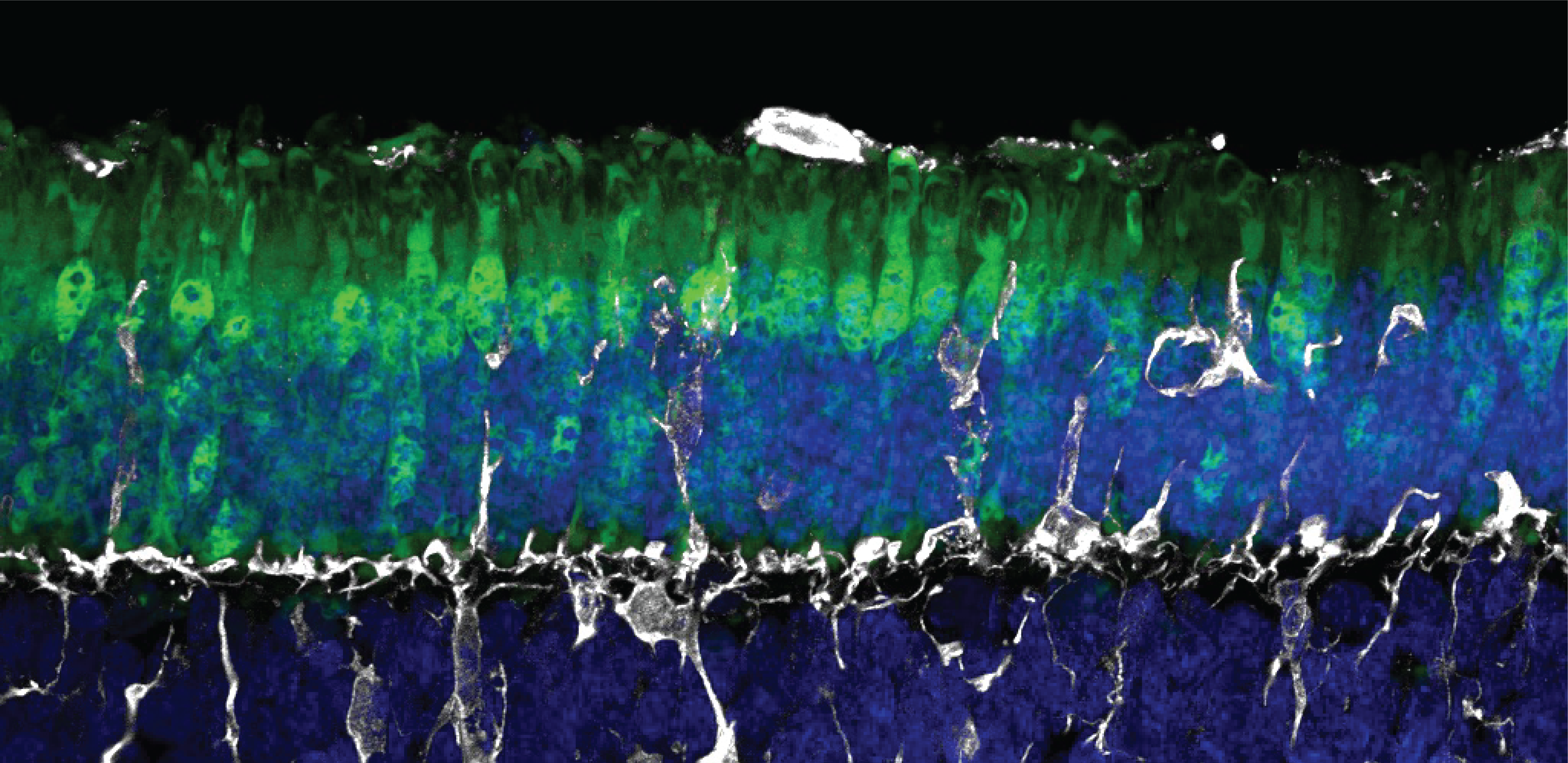 Fluorescence microscopy of retinal layers showing AAV transduction
